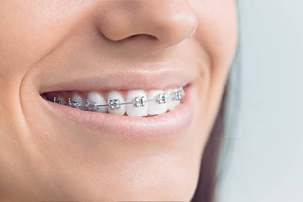 Best Veneers and Lumineers  in Madeira Beach, FL